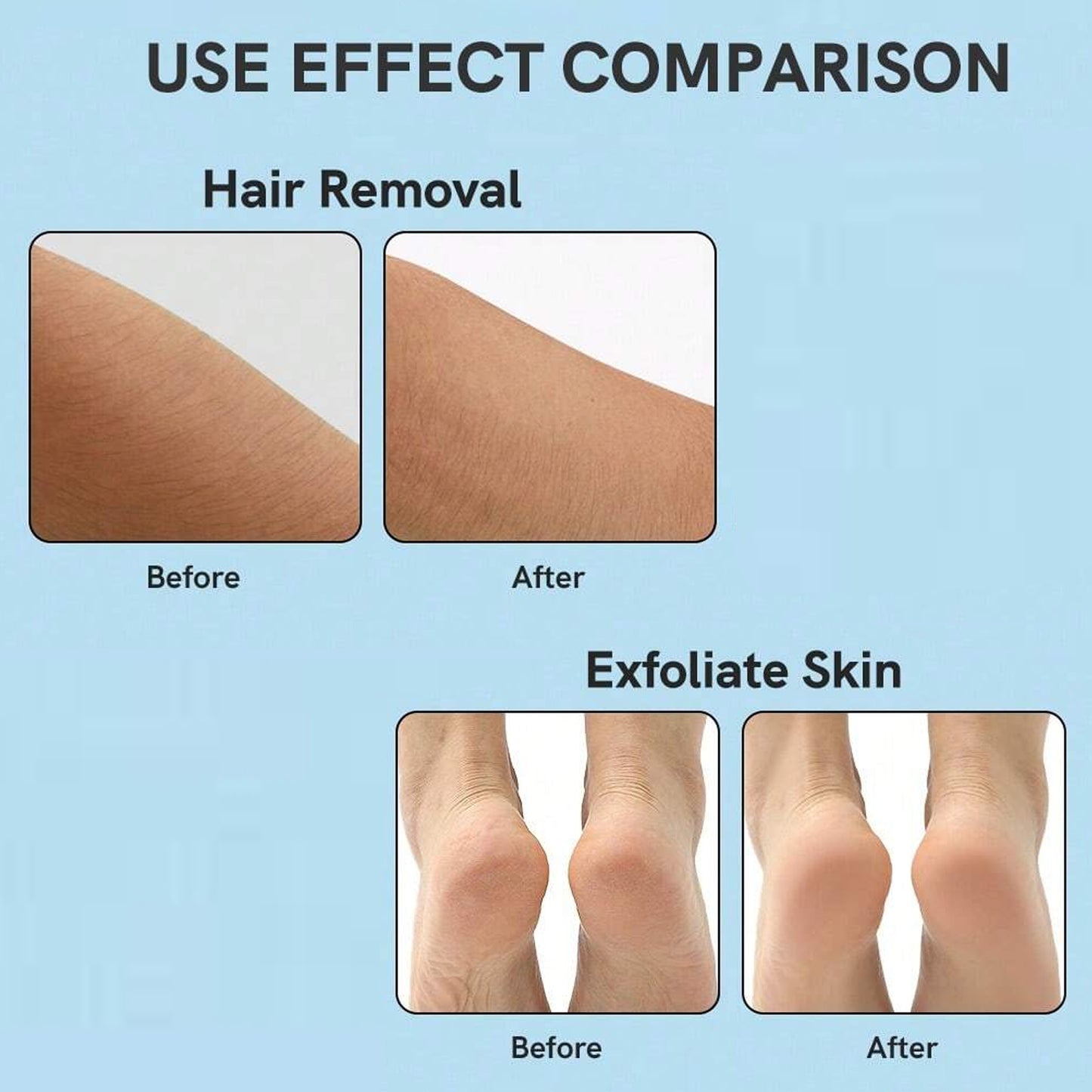 Nano Hair Remover For Arms & Legs (1 Pc)