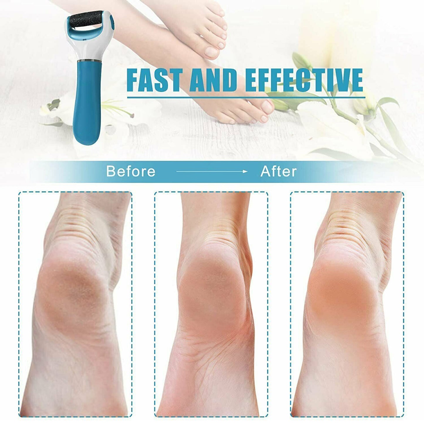Electric Dry foot Callos Remover